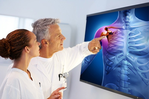 تصویری از یک دکتر و پرستار در حال نمایش به عکس یک بیمار که مشکلات استخوانی