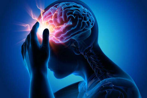 تصویر کامپیوتری از مغز انسان که دچار بیماری صرع است
