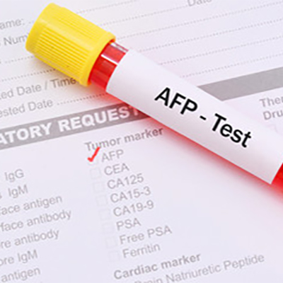 تصویری از یک شیشه آزمایش که روی آن نوشته شده AFP test