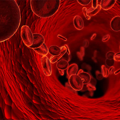 تصویری از گلبول های قرمز خون در رگ بیمار