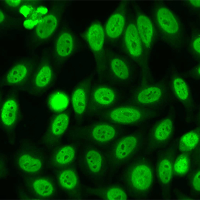 تصویری میکروسکوپی از آنتی بادی بیماری اسکلرودرما