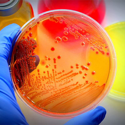 تصویری از یک پلیت یا محیط کشت باکتری و میکروب