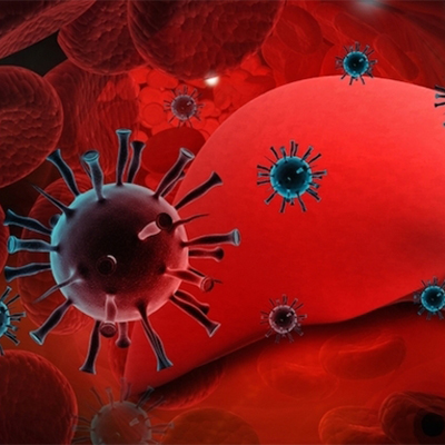 تصویری کامپیوتری از یک کبد که مبتلا به ویروس هپاتیت A شده