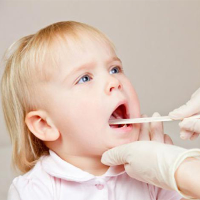 تصویری از یک دختر بچه که دکتر دارد دهان و حلق او را معاینه میکند