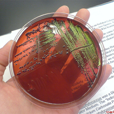تصویری از عفونت روی صفحه شیشه ای میکروسکوپ آزمایشگاه