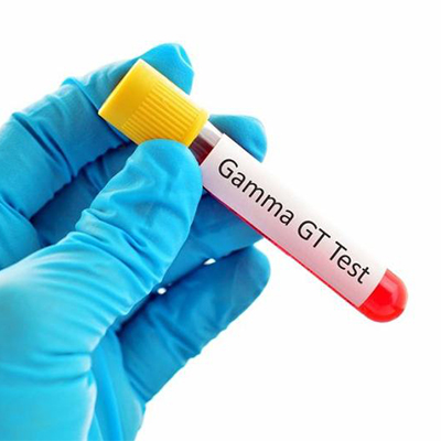 تصویری از یک شیشه خون آزمایشگاه که روی آن نوشته شده Gamma GT