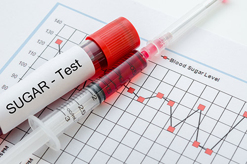 تصویری از دیک سرنگ و ویال خون که روی آن sugar test نوشته شده