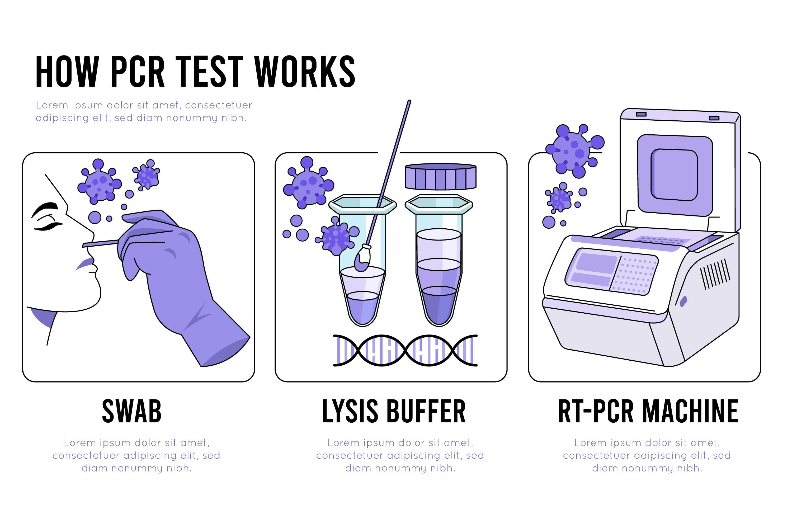 روش PCR برای آزمایش های ژنتیکی مثل تعیین ابوت