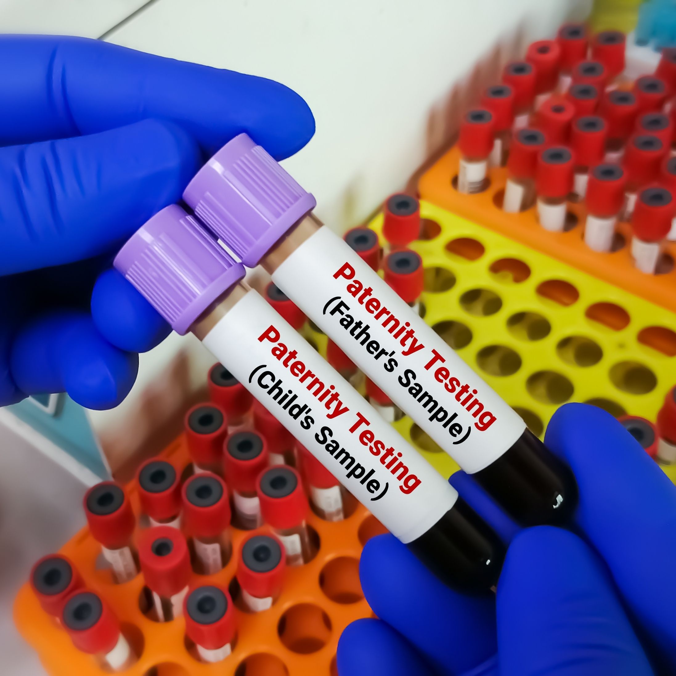 آزمایش Paternity test روی نمونه خون