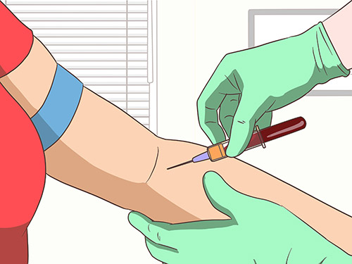 تصویری از یک دست که دارن با سرنگ از آن خون میگیرند
